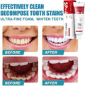 Premium YAYASHI SP-4 Ultra Whitening Probiotic Toothpaste – Advanced Red Tube Super Probiotic Stain Removal Oral Care