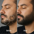 Beard Growth Serum
Vendor: RB Cosmetics
